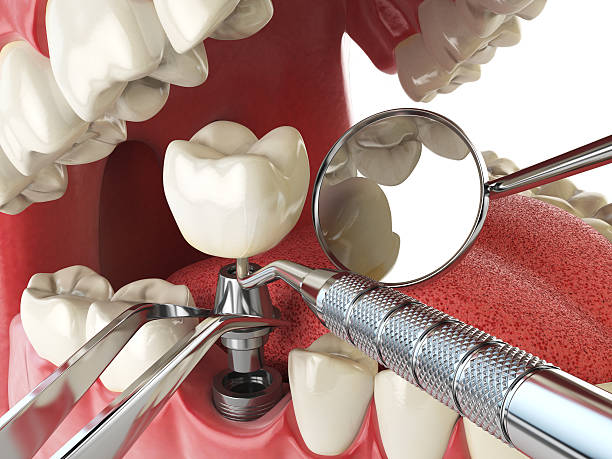 Best Broken or Cracked Tooth Emergency Dentist in Orchard Homes, MT